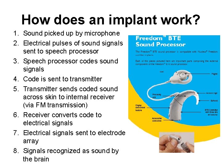 How does an implant work? 1. Sound picked up by microphone 2. Electrical pulses