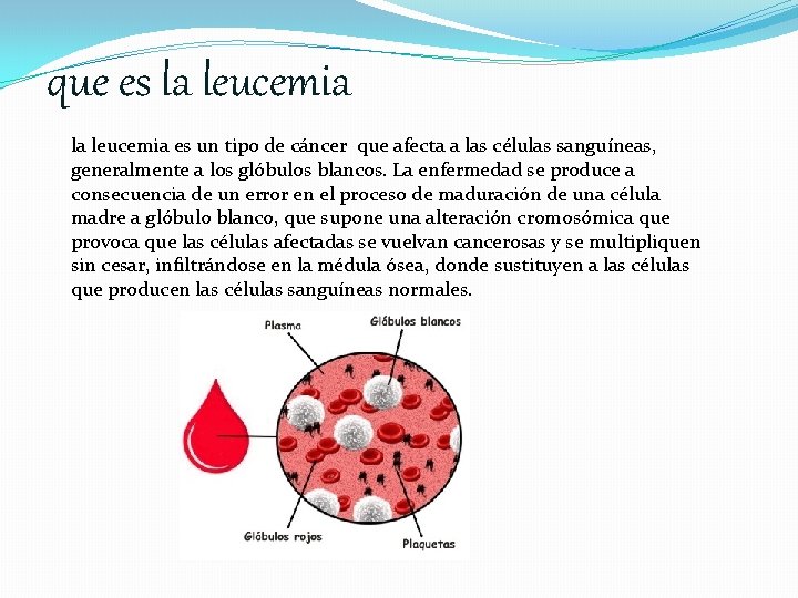 que es la leucemia es un tipo de cáncer que afecta a las células