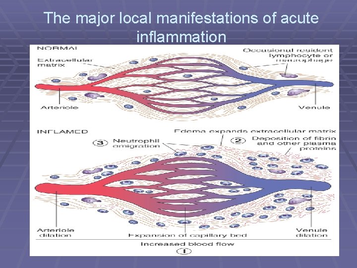 The major local manifestations of acute inflammation 