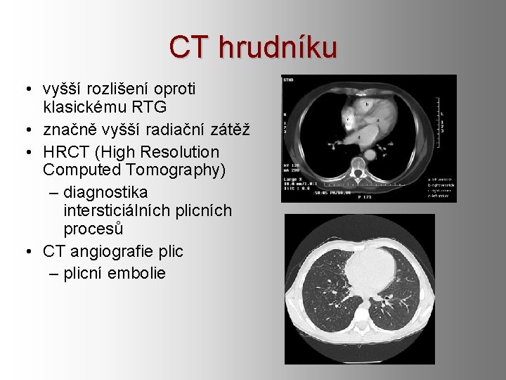 CT hrudníku • vyšší rozlišení oproti klasickému RTG • značně vyšší radiační zátěž • CT hrudníku • vyšší rozlišení oproti klasickému RTG • značně vyšší radiační zátěž •