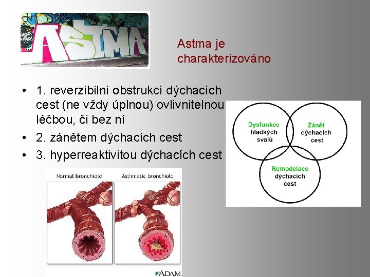 Astma je charakterizováno • 1. reverzibilní obstrukcí dýchacích cest (ne vždy úplnou) ovlivnitelnou léčbou, Astma je charakterizováno • 1. reverzibilní obstrukcí dýchacích cest (ne vždy úplnou) ovlivnitelnou léčbou,
