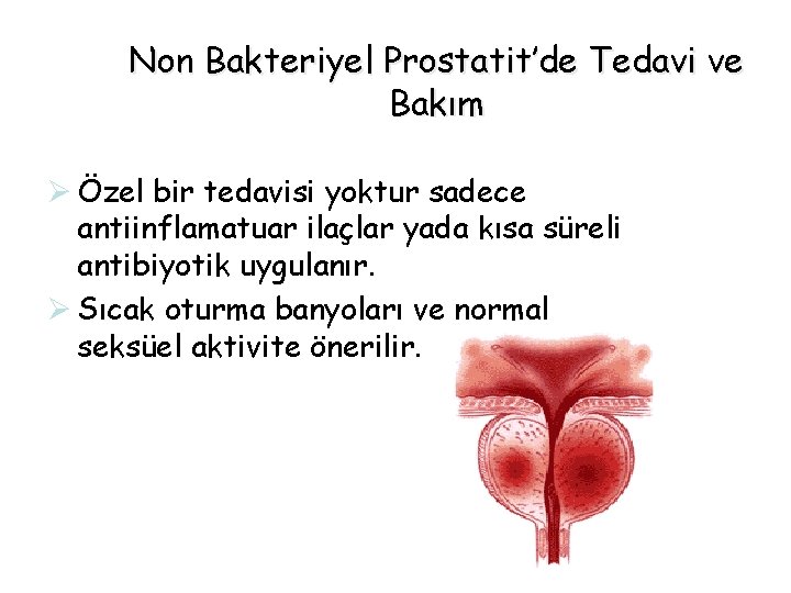 Non Bakteriyel Prostatit’de Tedavi ve Bakım Ø Özel bir tedavisi yoktur sadece antiinflamatuar ilaçlar Non Bakteriyel Prostatit’de Tedavi ve Bakım Ø Özel bir tedavisi yoktur sadece antiinflamatuar ilaçlar