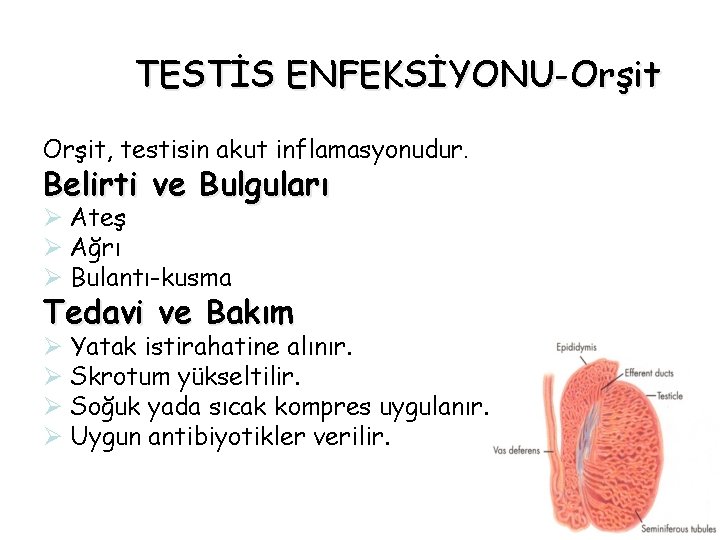 TESTİS ENFEKSİYONU-Orşit, testisin akut inflamasyonudur. Belirti ve Bulguları Ø Ateş Ø Ağrı Ø Bulantı-kusma TESTİS ENFEKSİYONU-Orşit, testisin akut inflamasyonudur. Belirti ve Bulguları Ø Ateş Ø Ağrı Ø Bulantı-kusma