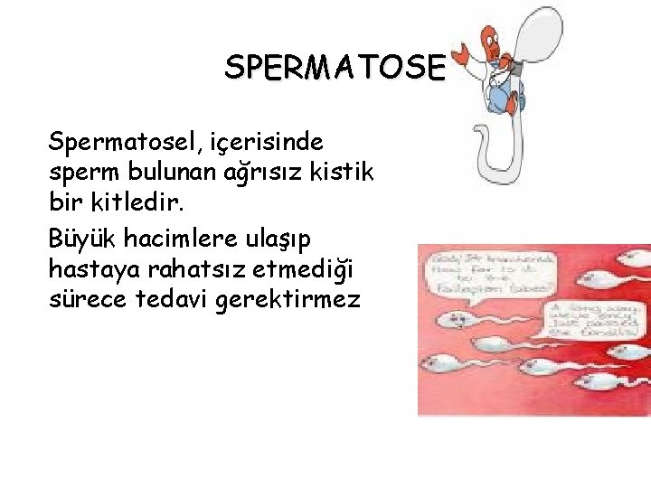 SPERMATOSEL Spermatosel, içerisinde sperm bulunan ağrısız kistik bir kitledir. Büyük hacimlere ulaşıp hastaya rahatsız SPERMATOSEL Spermatosel, içerisinde sperm bulunan ağrısız kistik bir kitledir. Büyük hacimlere ulaşıp hastaya rahatsız