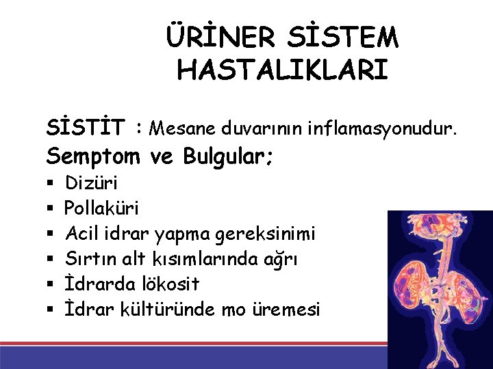 ÜRİNER SİSTEM HASTALIKLARI SİSTİT : Mesane duvarının inflamasyonudur. Semptom ve Bulgular; § § § ÜRİNER SİSTEM HASTALIKLARI SİSTİT : Mesane duvarının inflamasyonudur. Semptom ve Bulgular; § § §