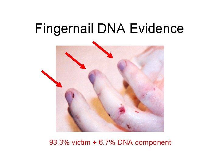 Fingernail DNA Evidence 93. 3% victim + 6. 7% DNA component 