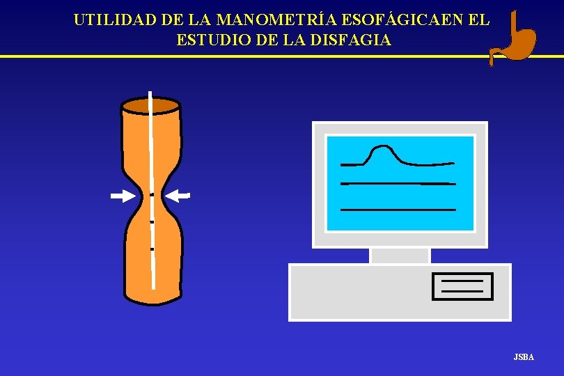 UTILIDAD DE LA MANOMETRÍA ESOFÁGICAEN EL ESTUDIO DE LA DISFAGIA JSBA UTILIDAD DE LA MANOMETRÍA ESOFÁGICAEN EL ESTUDIO DE LA DISFAGIA JSBA