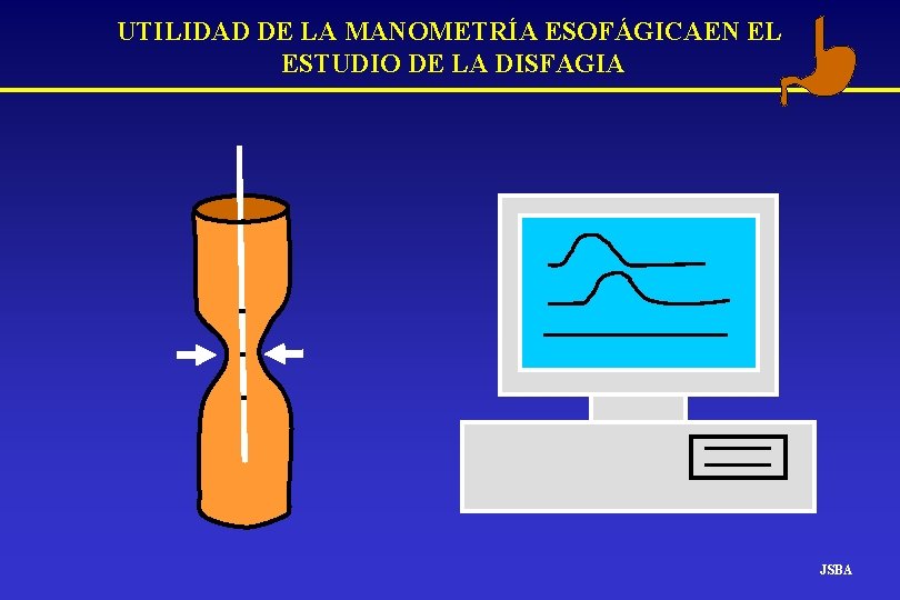 UTILIDAD DE LA MANOMETRÍA ESOFÁGICAEN EL ESTUDIO DE LA DISFAGIA JSBA UTILIDAD DE LA MANOMETRÍA ESOFÁGICAEN EL ESTUDIO DE LA DISFAGIA JSBA