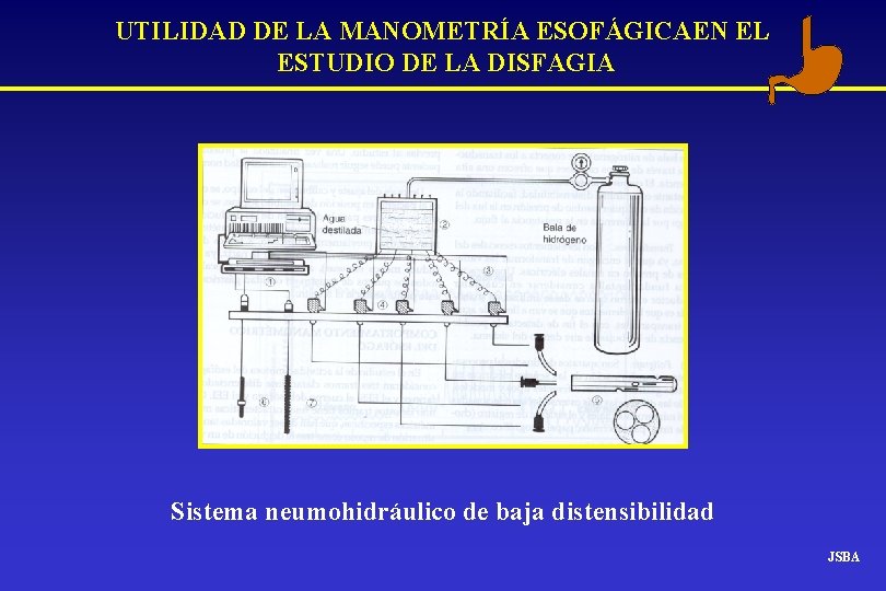 UTILIDAD DE LA MANOMETRÍA ESOFÁGICAEN EL ESTUDIO DE LA DISFAGIA Sistema neumohidráulico de baja UTILIDAD DE LA MANOMETRÍA ESOFÁGICAEN EL ESTUDIO DE LA DISFAGIA Sistema neumohidráulico de baja