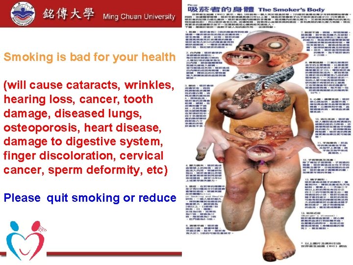 Smoking is bad for your health (will cause cataracts, wrinkles, hearing loss, cancer, tooth Smoking is bad for your health (will cause cataracts, wrinkles, hearing loss, cancer, tooth