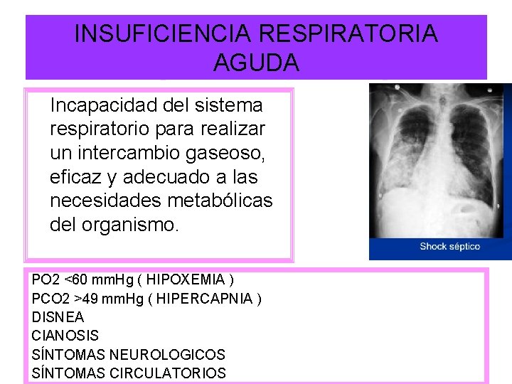 INSUFICIENCIA RESPIRATORIA AGUDA Incapacidad del sistema respiratorio para realizar un intercambio gaseoso, eficaz y INSUFICIENCIA RESPIRATORIA AGUDA Incapacidad del sistema respiratorio para realizar un intercambio gaseoso, eficaz y