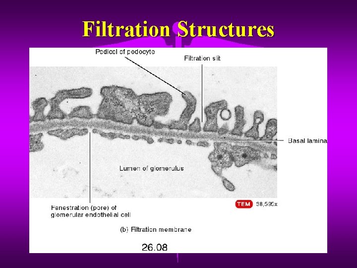 Filtration Structures 