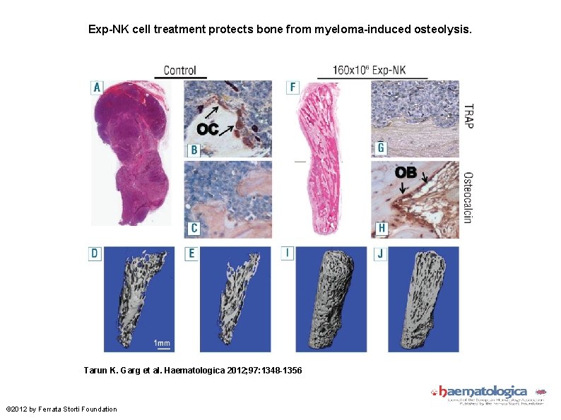 Exp-NK cell treatment protects bone from myeloma-induced osteolysis. Tarun K. Garg et al. Haematologica