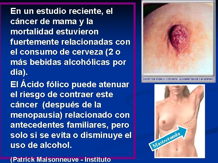 En un estudio reciente, el cáncer de mama y la mortalidad estuvieron fuertemente relacionadas