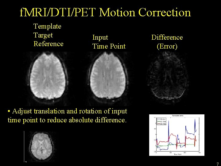 f. MRI/DTI/PET Motion Correction Template Target Reference Input Time Point Difference (Error) • Adjust