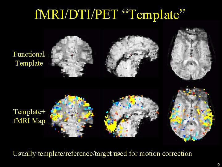 f. MRI/DTI/PET “Template” Functional Template+ f. MRI Map Usually template/reference/target used for motion correction