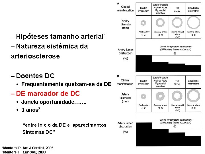 – Hipóteses tamanho arterial 1 – Natureza sistémica da arteriosclerose – Doentes DC •