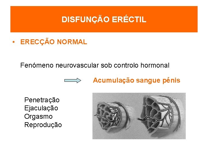 DISFUNÇÃO ERÉCTIL • ERECÇÃO NORMAL Fenómeno neurovascular sob controlo hormonal Acumulação sangue pénis Penetração