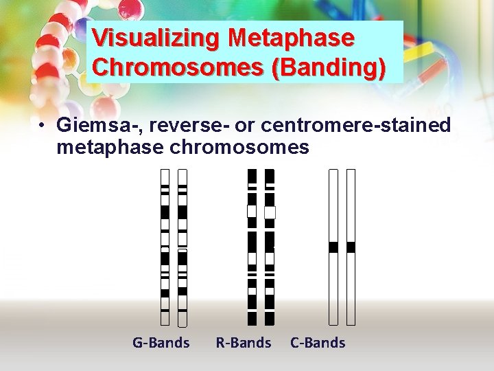 Visualizing Metaphase Chromosomes (Banding) • Giemsa-, reverse- or centromere-stained metaphase chromosomes G-Bands R-Bands C-Bands Visualizing Metaphase Chromosomes (Banding) • Giemsa-, reverse- or centromere-stained metaphase chromosomes G-Bands R-Bands C-Bands
