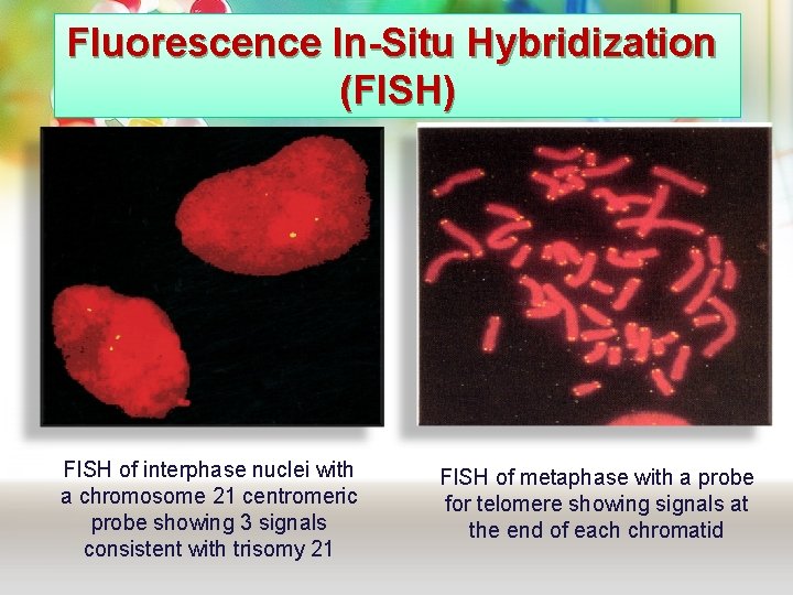 Fluorescence In-Situ Hybridization (FISH) FISH of interphase nuclei with a chromosome 21 centromeric probe Fluorescence In-Situ Hybridization (FISH) FISH of interphase nuclei with a chromosome 21 centromeric probe