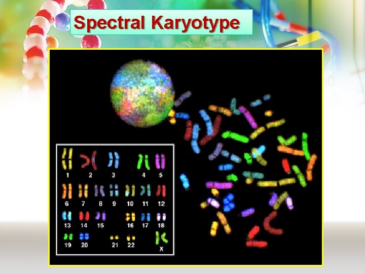 Spectral Karyotype Spectral Karyotype