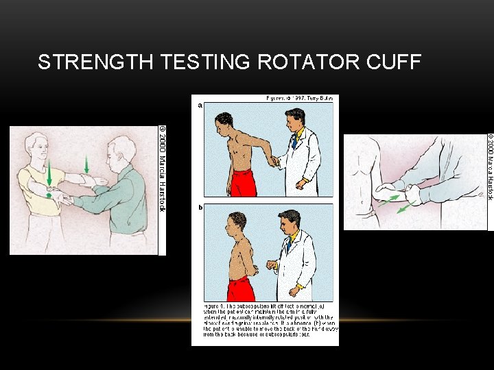 STRENGTH TESTING ROTATOR CUFF 