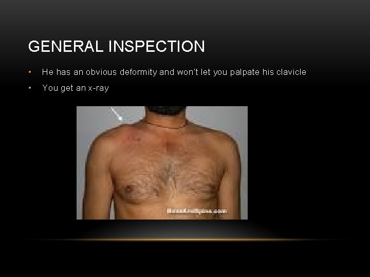 GENERAL INSPECTION • He has an obvious deformity and won’t let you palpate his