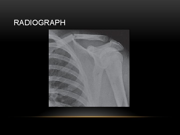 RADIOGRAPH 