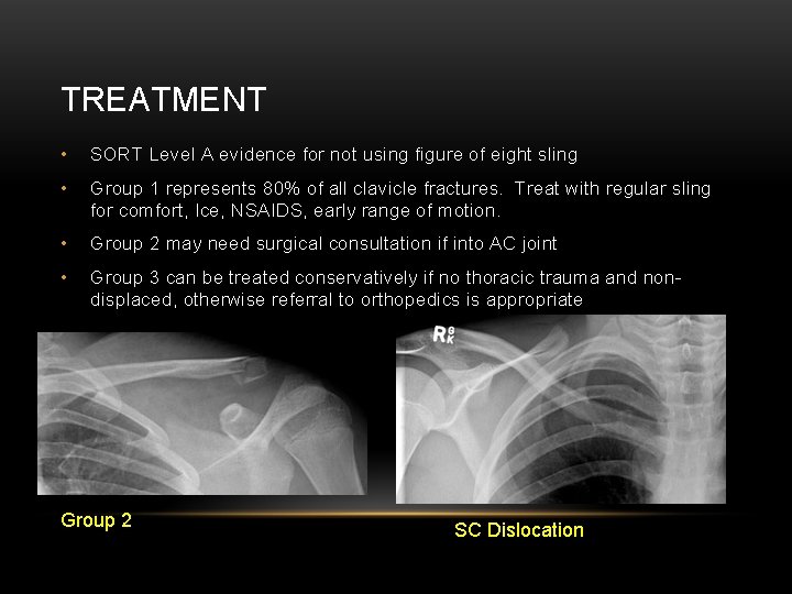 TREATMENT • SORT Level A evidence for not using figure of eight sling •