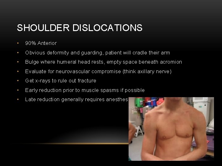 SHOULDER DISLOCATIONS • 90% Anterior • Obvious deformity and guarding, patient will cradle their