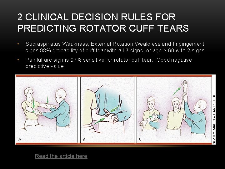 2 CLINICAL DECISION RULES FOR PREDICTING ROTATOR CUFF TEARS • Supraspinatus Weakness, External Rotation