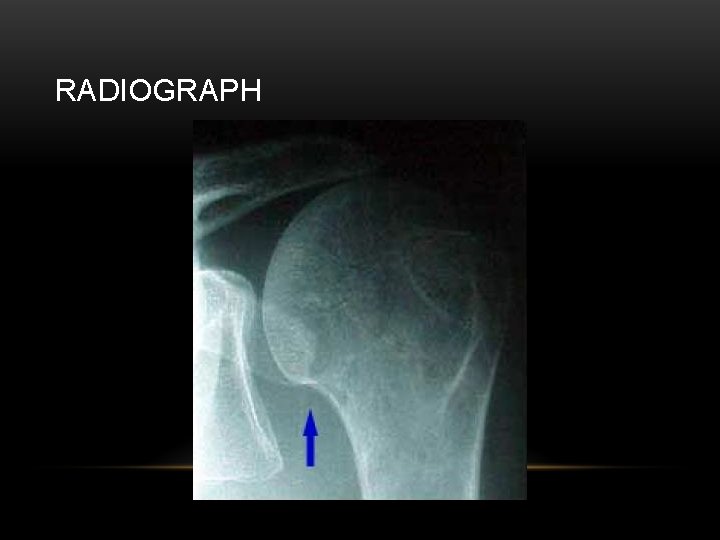 RADIOGRAPH 