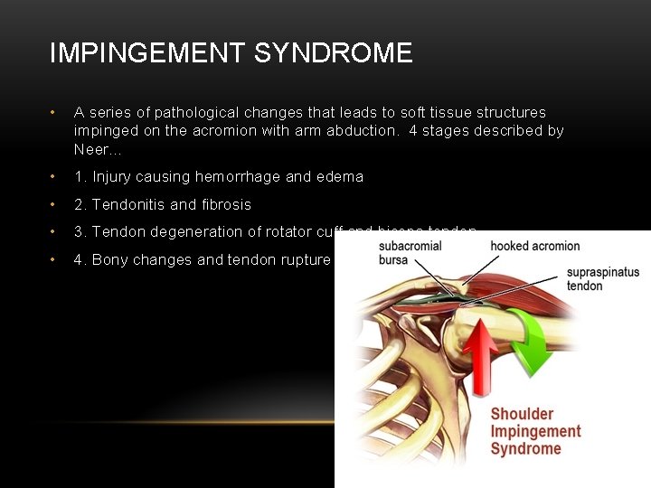 IMPINGEMENT SYNDROME • A series of pathological changes that leads to soft tissue structures