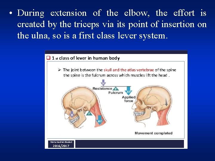  • During extension of the elbow, the effort is created by the triceps