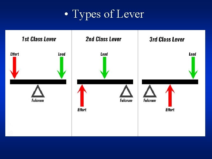  • Types of Lever 