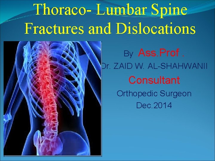 Thoraco- Lumbar Spine Fractures and Dislocations By Ass. Prof. Dr. ZAID W. AL-SHAHWANII Consultant