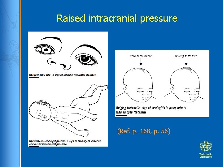 Raised intracranial pressure (Ref. p. 168, p. 56) 