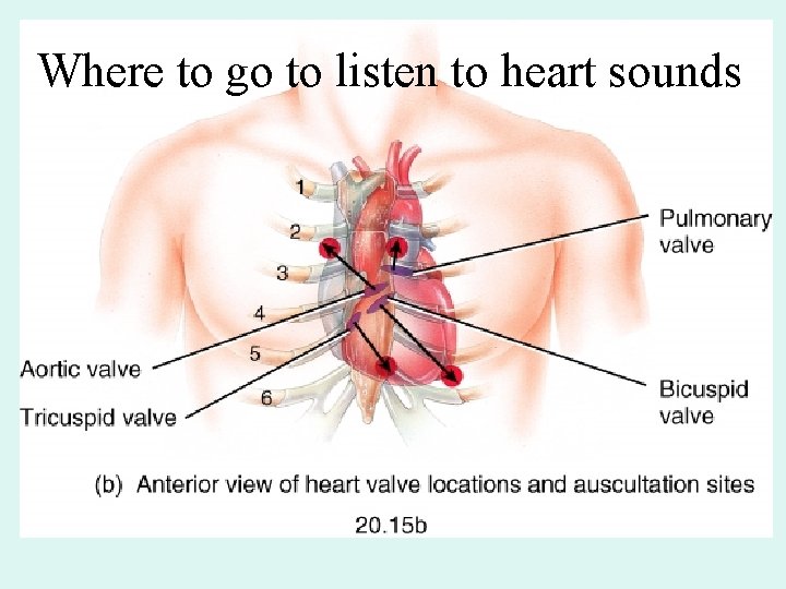 Where to go to listen to heart sounds Where to go to listen to heart sounds