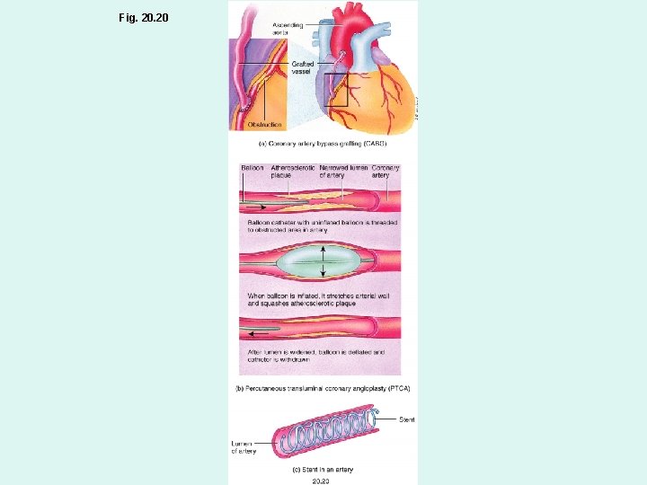Fig. 20 Fig. 20