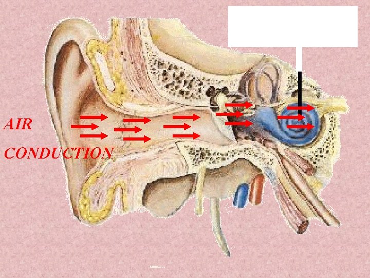 AIR CONDUCTION 