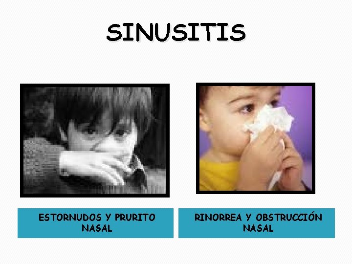 SINUSITIS ESTORNUDOS Y PRURITO NASAL RINORREA Y OBSTRUCCIÓN NASAL 