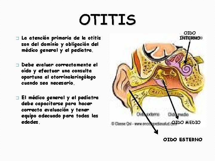 OTITIS � � � La atención primaria de la otitis son del dominio y