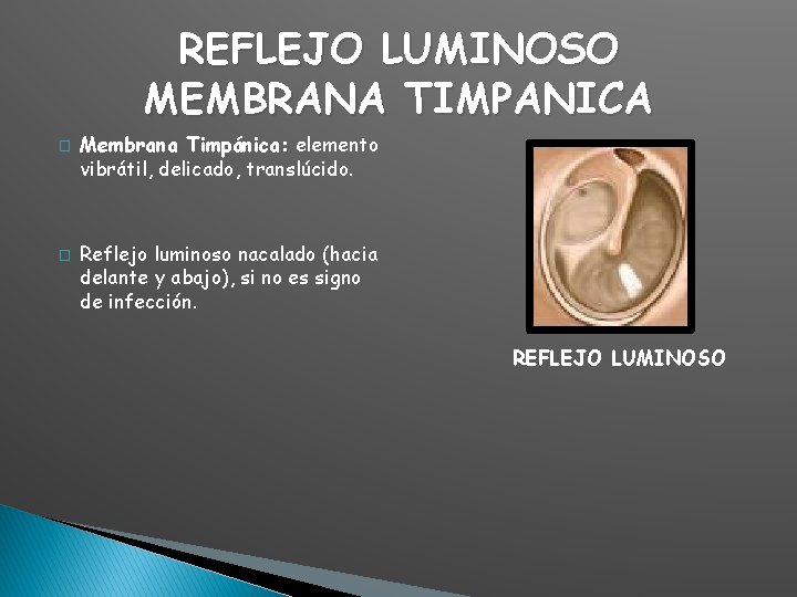 REFLEJO LUMINOSO MEMBRANA TIMPANICA � � Membrana Timpánica: elemento vibrátil, delicado, translúcido. Reflejo luminoso