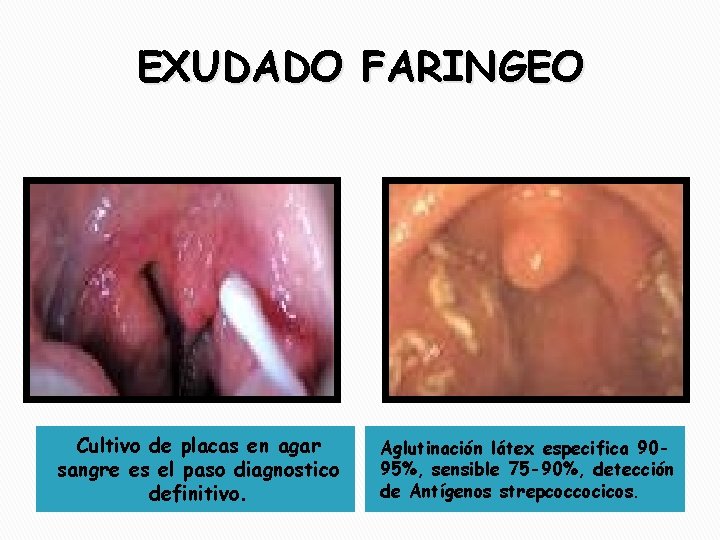 EXUDADO FARINGEO Cultivo de placas en agar sangre es el paso diagnostico definitivo. Aglutinación