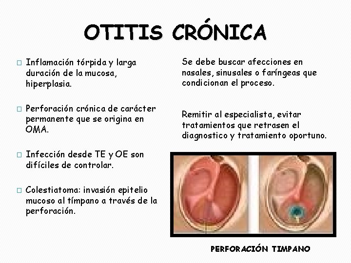 OTITIS CRÓNICA � � Inflamación tórpida y larga duración de la mucosa, hiperplasia. Perforación