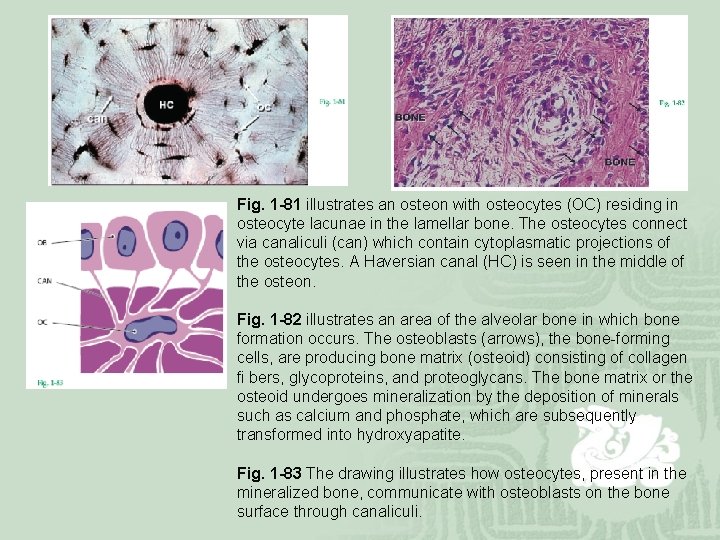 Fig. 1 -81 illustrates an osteon with osteocytes (OC) residing in osteocyte lacunae in