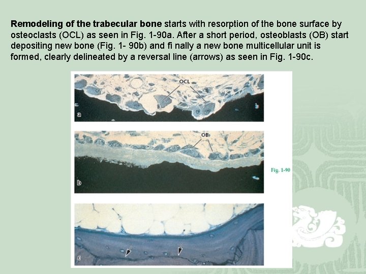 Remodeling of the trabecular bone starts with resorption of the bone surface by osteoclasts