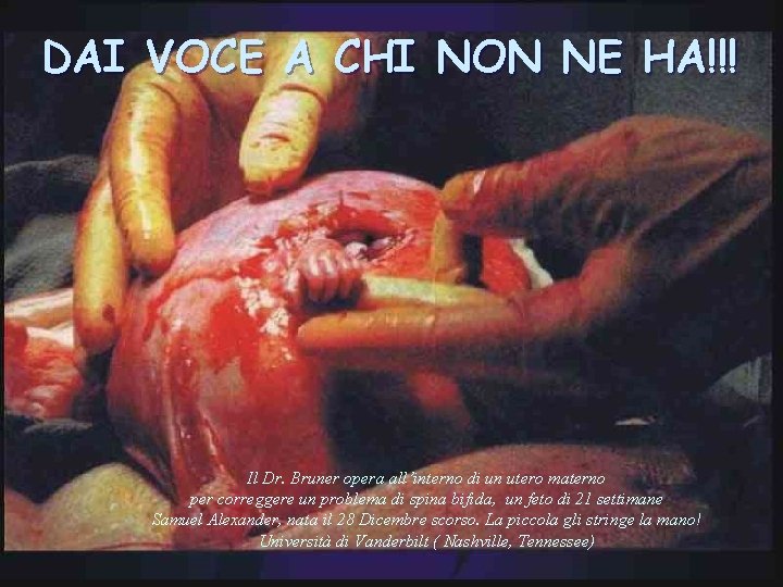 DAI VOCE A CHI NON NE HA!!! Il Dr. Bruner opera all’interno di un