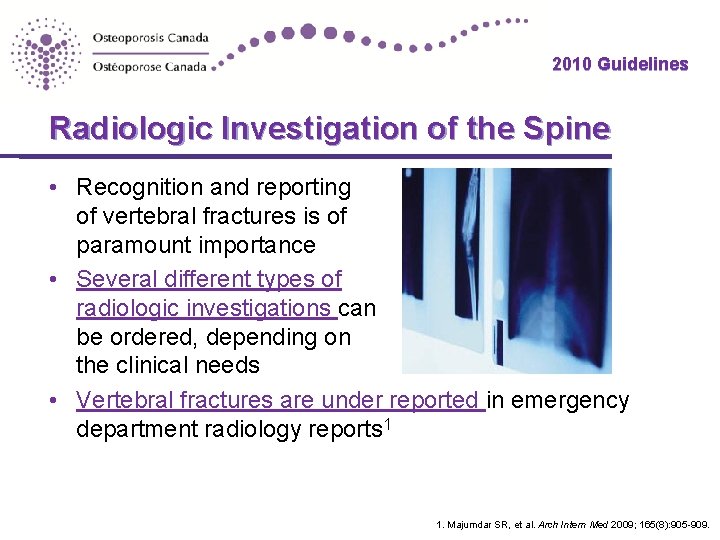 2010 Guidelines Radiologic Investigation of the Spine • Recognition and reporting of vertebral fractures