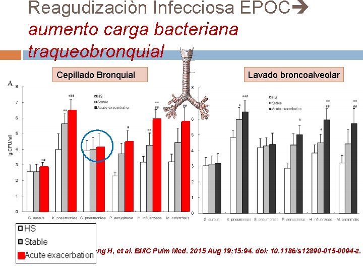 Reagudizaciòn Infecciosa EPOC aumento carga bacteriana traqueobronquial Cepillado Bronquial Lavado broncoalveolar Wang H, et